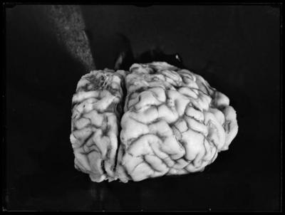 Fotografia di un cervello per il Prof. dott. Giovanni Bolzani